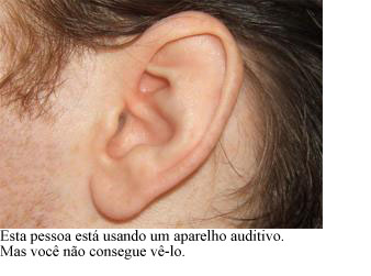 Aparelho Auditivo
