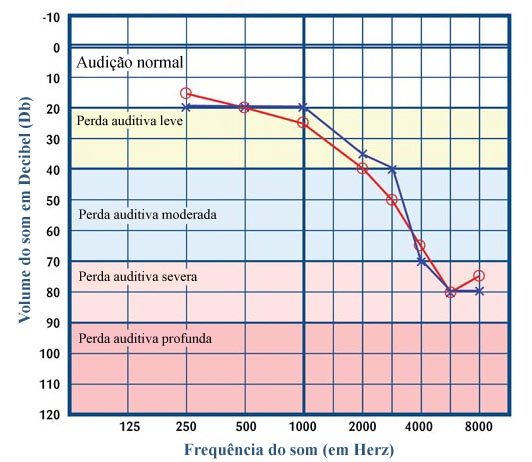 audiometria