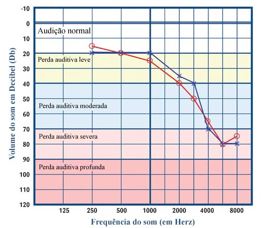 audiometria